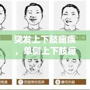 突发上下肢瘫痪,单侧上下肢瘫痪